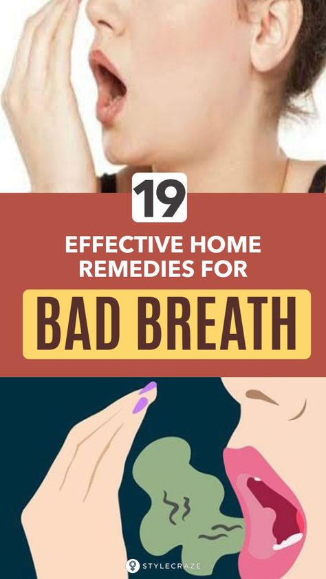 Best Gum For Bad Breath, Diy Bad Breath Remedies, Natural Bad Breath Remedies, Better Breath Smell, How To Get Rid Of Bad Breath, Bad Breath Remedy How To Get Rid Of, Remedies For Bad Breath, Mouth Hygiene, Mouth Care