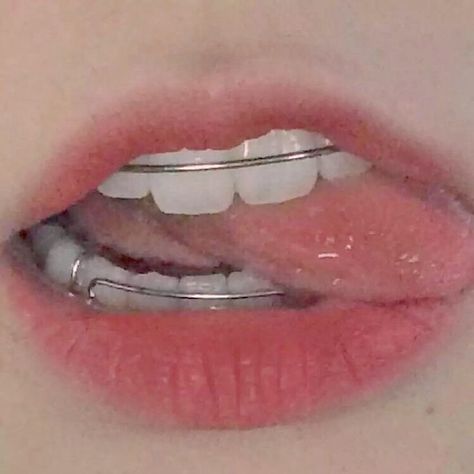 Cute Braces Colors, Braces Girls, Cute Braces, Brace Face, Braces Colors, Teeth Braces, Teeth Jewelry, روتين العناية بالبشرة, Lip Art