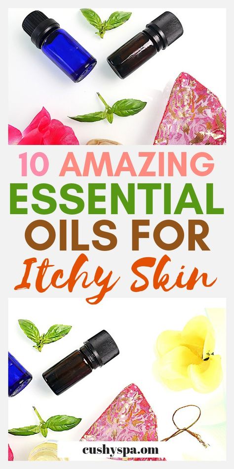 Looking for itchy skin remedies, essential oils for itching might be exactly what you need. Try some of the essential oil blends inside too! #essentialoils #skincare #skintips #aromatherapy Essential Oils For Itchy Skin, Essential Oil For Itchy Skin Itch Relief, Essential Oils Itchy Skin, Oils For Itchy Skin, Essential Oils For Itching, Itchy Skin Remedies, Remedy For Itchy Skin, Gods Child, Itchy Skin Remedy