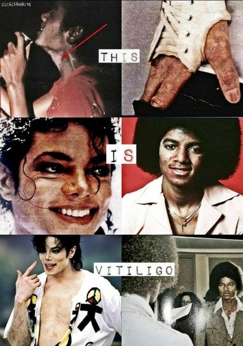 I know how much he suffered because my grandma had vitiligo too 😢 Mj Quotes, Mike Jackson, Hee Man, Michael Jackson Funny, Michael Jackson Quotes, Michael Jackson Wallpaper, Michael Jackson Smile, Joseph Jackson, Michael Jackson Pics