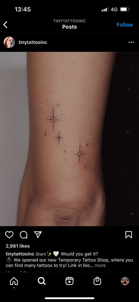 To The Stars Tattoo, Under The Stars Tattoo, Stars Around Scar Tattoo Design, Stars On Elbow Tattoo, Starry Tattoos For Women, Sparkle Back Tattoo, Star Tattoo Back Of Arm, Shining Light Tattoo, Binary Stars Tattoo