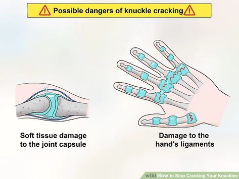 How to Stop Cracking Your Knuckles: 13 Steps (with Pictures) How To Stop Cracking Your Knuckles, Cracking Knuckles, Knuckle Cracking, Finger Exercises, Sinus Relief, Healthy Advice, Side Effects, The Line, Something To Do