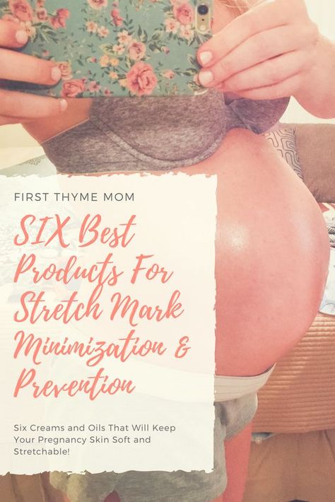 Stretch Mark Prevention Pregnancy, Stretch Mark Remedies, Stretch Mark Cream, Pregnancy Advice, Pregnancy Information, Stretch Mark, Baby Sleep Problems, Morning Sickness, Mama Mia