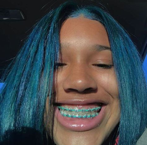 Brace Colors, Braces Colors Combinations, Braces Colours, Green Braces, Braces Retainer, Braces And Glasses, Braces Colors Ideas, Braces Ideas, Maquillage Kylie Jenner