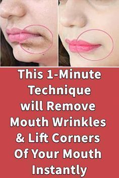 Wrinkles Remedies Face, Obličejové Masky, Home Remedies For Wrinkles, Mouth Wrinkles, Wrinkle Remedies, Wrinkle Free Skin, Lip Wrinkles, Skin Care Wrinkles, Face Wrinkles