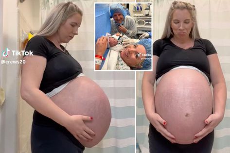 Triplet Baby Bump, Triplets Pregnancy Belly, Pregnant With Triplets Belly, Triplets Pregnancy, Big Pregnant, Baby Bump Pictures, Pregnancy Belly, Triplet Babies, Baby Live