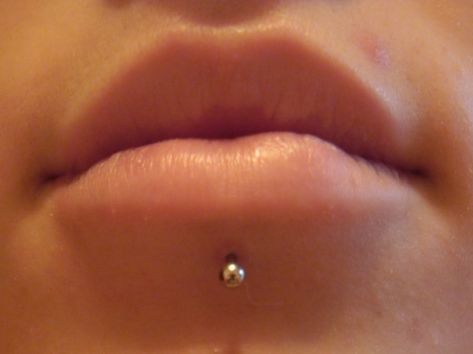 Dealing with excess scar tissue on lip piercings.  Recommendations include aspirin powder, alcohol, hydrogen peroxide, campho-phenique, and even AHA.  ALWAYS check with your piercer before using any of these, and ONLY use them on excess scars (not on normally-healing wounds). Side Lip Piercing Studs, Lip Piercing Side Stud, Lip Piercing Shark Bites, Lower Lip Piercing Side Ring, Bottom Lip Piercing Middle Stud, Chin Piercing, Piercings Lip, Facial Piercing, Lip Piercing Ring