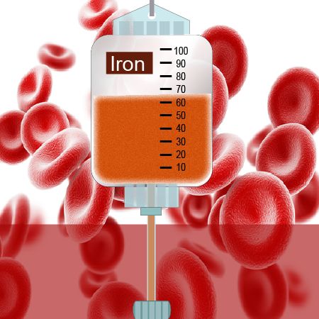 Iron Infusion, Fe Iron, Heart Fail, Electron Transport Chain, Hemoglobin Levels, Iron Deficiency, Patient Education, Emergency Medicine, Bone Marrow