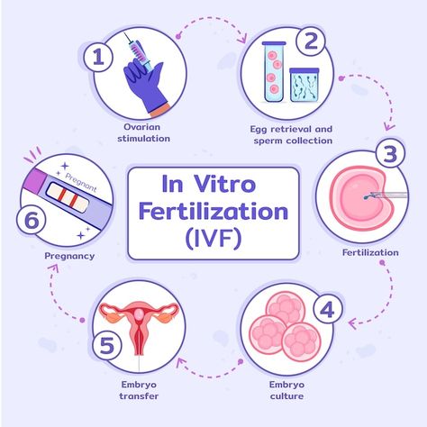 Free vector hand drawn flat design ivf i... | Free Vector #Freepik #freevector #design-process #infographic-template #hand-drawn-infographic #process-infographic Ivf Failure, Fertilization Process, Ivf Success Rates, Ivf Procedure, Ivf Cost, Egg Donor, Ivf Cycle, Ivf Success, Embryo Transfer