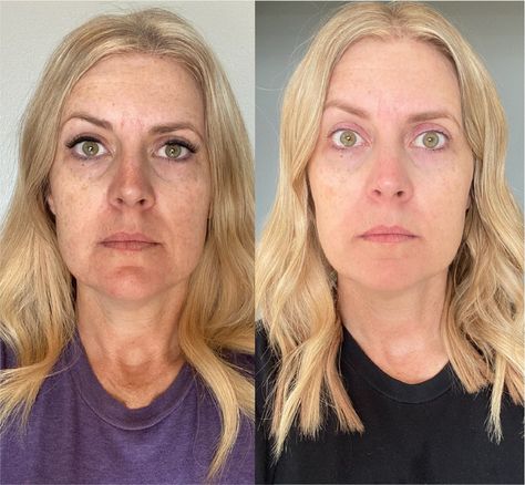 Collagen Results Collagen Before And After, Collagen Before And After Pictures, Taking Collagen, Orange Theory, Collagen Benefits, Help Digestion, Collagen Supplements, Before After Photo, Build Lean Muscle