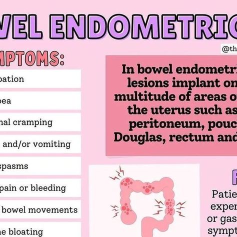 Endometriosis Society on Instagram: "Endometriosis of the bowel information 💜 Do you struggle with bowel endometriosis? Do you suspect it due to symptoms you may have? Or have you had surgery on the bowel? Let us know!
Cre: @@the__endo__space 
.
.
.

#endometriosisjourney
#endometriosisandcannabis
#endometriosisjsr
#endometriosisisreal
#endometriosismexico
#endometriosiswarrior💛
#endometriosis💛
#endometriosisaustralia
#endometriosisfighter
#endometriosisuk
#endometriosissucks
#endometriosispain
#endometriosissupport
#endometriosiswarrior
#endometriosissurgery" Surgery, Let It Be, On Instagram, Instagram