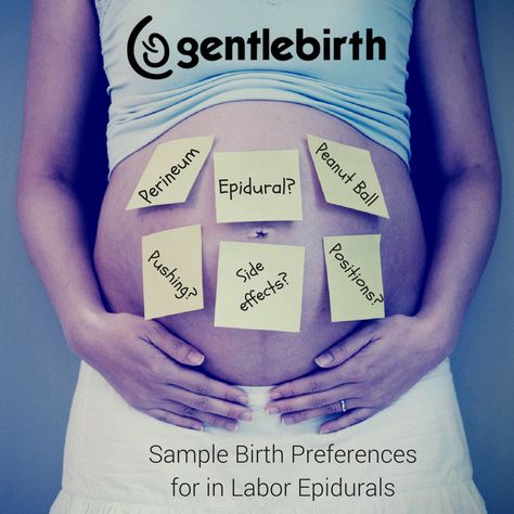 Epidural Birth, Birth Preferences, Birth Prep, Peanut Ball, Timer App, Birth Preparation, Natural Pain Relievers, Nurse Midwife, Birth Labor