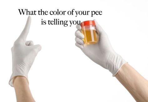 urine Pee Color, Color Of Urine, Cloudy Urine, Pee Smell, Rare Genetic Disorders, Signs Of Dehydration, Urine Odor, Water Per Day, To Pee