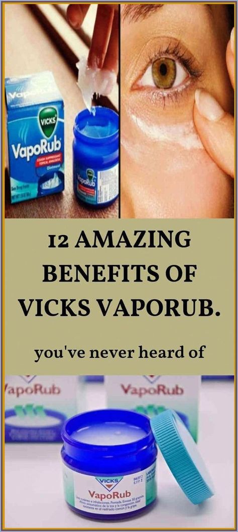 Vapo Rub, Vicks Vapor Rub, Vicks Vapor, Chesty Cough, Vicks Vaporub Uses, Uses For Vicks, Sinus Headache, Vapor Rub, Sinus Congestion