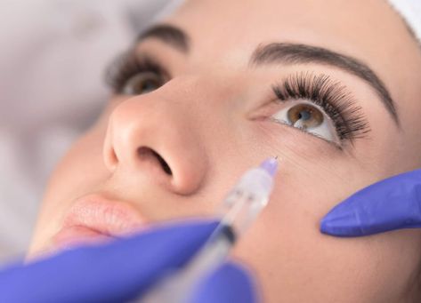 Botox Eyes, Botox Under Eyes, Botox Results, Botox Before And After, Eyelid Lift, Forehead Wrinkles, Eye Surgery, Under Eye Bags, Cosmetic Procedures