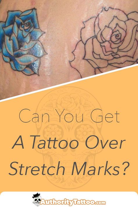 Here we explain everything you need to know about just how easy, or hard it may be to get tattooed over one (or many) of your stretch marks. Tattoos To Cover Strech Marks, Strech Marks Tatoos, Tattoos Over Stretch, Tattoo Stretch Mark Cover Up, Tattoo On Strechmark, Stretch Mark Tattoo Cover Up, Stretchmark Cover Tattoos, Tattoo Over Strechmark, Stretch Mark Tattoos