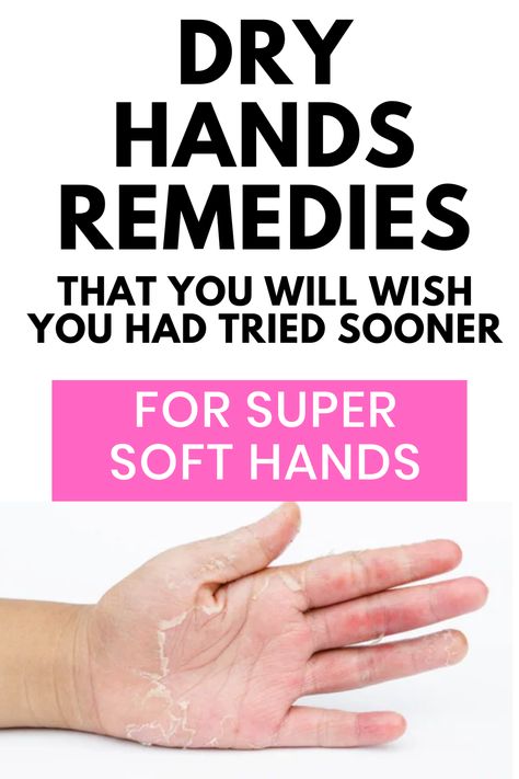 Say goodbye to rough, dry hands with our expert tips and tricks! Discover natural remedies, DIY hand masks, and nourishing hand creams to keep your hands soft and supple, even in the harshest of weather conditions. Follow us for more helpful beauty and skincare advice given by a pharmacist How To Get Soft Hand Palms, Diy Hand Cream For Dry Skin, Best Hand Cream For Dry Hands, Soft Hands Tips, How To Soften Hands, Hand Mask For Dry Hands, Cracked Hands Remedy, Dry Hands Remedy, Hand Cream Recipe