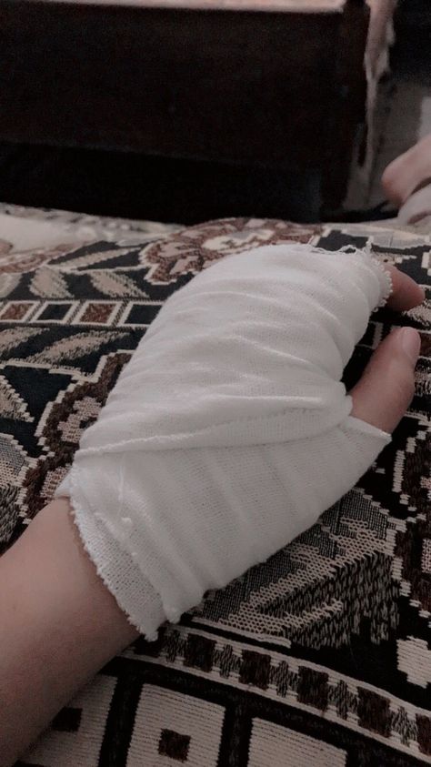 Accident Hand Dpz, Leg Bandage Snapchat, Burned Hand Pic, Injured Leg, Bandaged Hands, Hospital Admit, Cute Photo Poses, Hospital Admit Hand Pics, Gym Guys