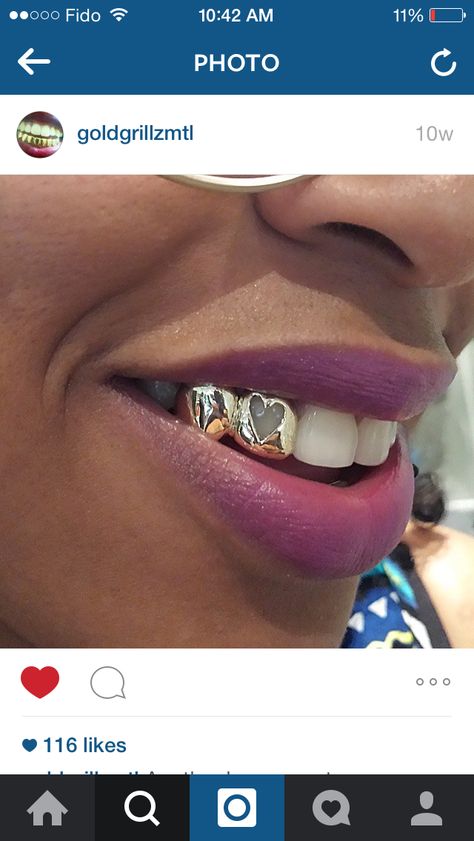 Gold grill with a heart Open Face Heart Grillz, Gap Grillz, Mouth Grills, Teeth Grills, Bottom Grillz, Bun Braid, Gold Grill, Gold Grillz, Gap Teeth