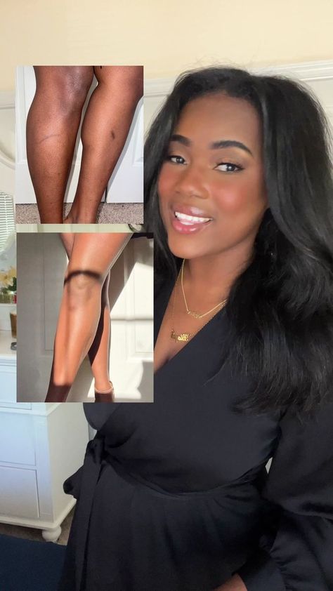 Even Tone Skin How To Get, How To Even Skin Tone Naturally, Even Toned Body Skin, Even Body Skin Tone, How To Even Out Skin Tone Black Women, Westmore Beauty, Skin Transformation, Colors For Skin Tone, Confidence Boost