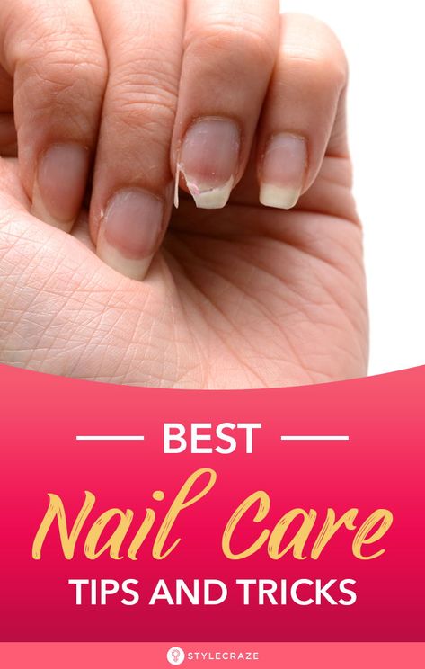 Nail Tricks, Bday Decor, Nail Hacks, Nails Care, Boricua Recipes, Natural Nail Care, Natural Nail Designs, Plain Nails, Health Signs