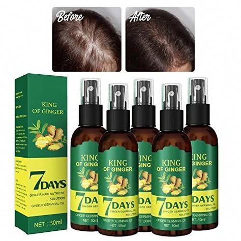 Ginger Oil For Hair, Ginger Hair Growth, Thicker Stronger Hair, Thick Hair Growth, Stop Hair Breakage, Hair Growth Spray, Oil For Hair Growth, Japanese Hair, Ginger Oil