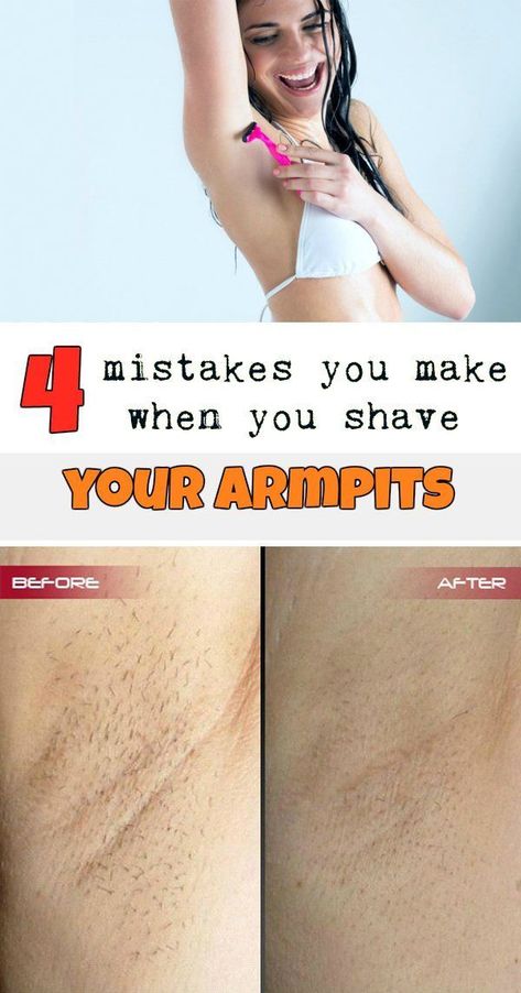 Hacks Every Girl Should Know, Smart Life, Ingrown Hair, Life Changing, Every Girl, Beauty Care, Hair Removal, Face And Body, Skin Care Tips