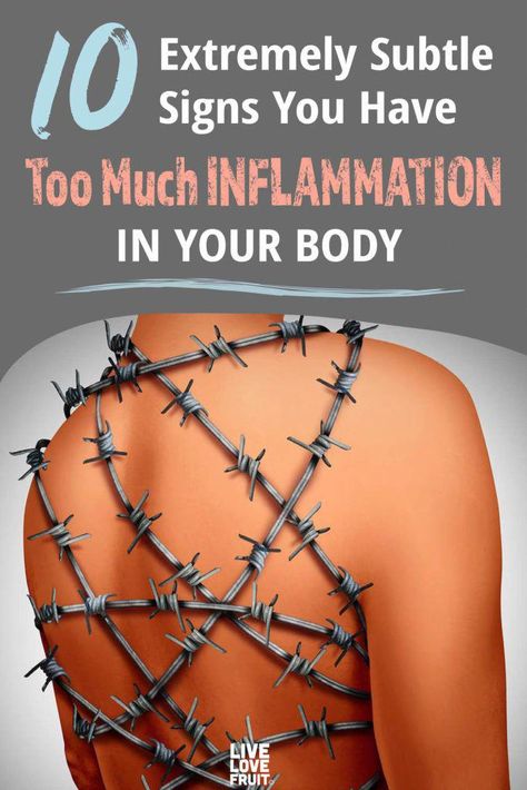 Inflammation is the backbone of chronic disease. Here's how to reduce chronic inflammation throughout your body and boost your immune system! Muscle Gain Meal Plan, Diet Schedule, Healthy Heart Tips, Blood Sugar Diet, Unhealthy Diet, Nose Shapes, Muscle Gain, Boost Your Immune System, Health Research