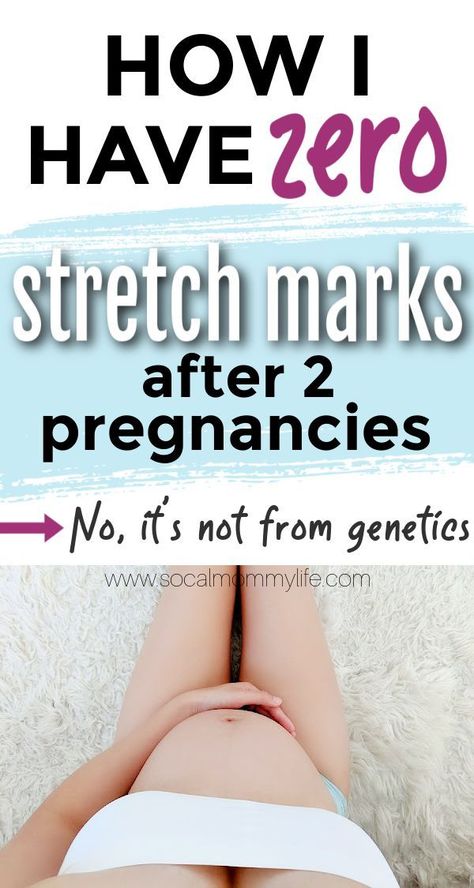 Preventing Pregnancy Stretchmarks, Stretch Mark Pregnancy Prevent, How To Prevent Pregnancy Stretchmarks, Pregnancy Stretch Mark Routine, Stretch Mark Prevention Pregnancy, Best Hand Cream, Stretch Mark Prevention, Postpartum Exercises, Pregnancy Exercises