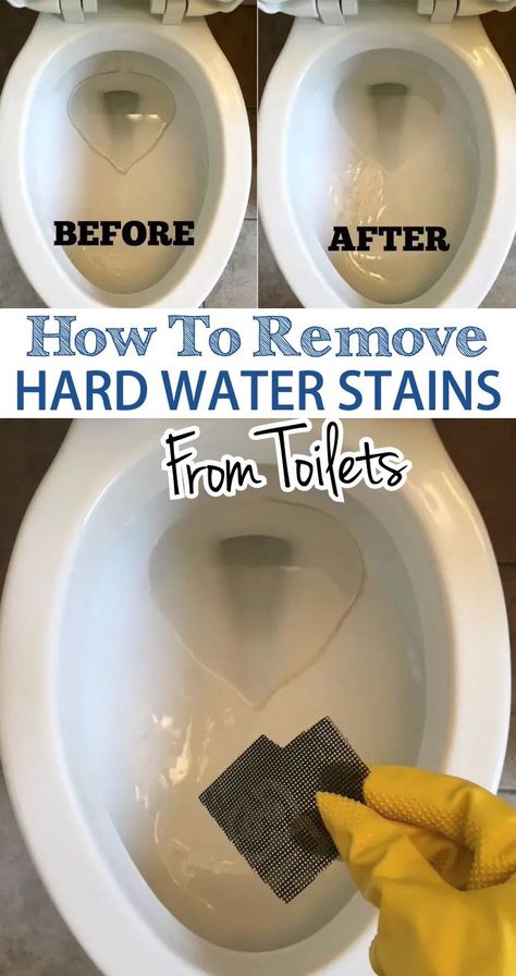 Ring In Toilet, Hard Water Ring In Toilet, Ring Around The Toilet, Toilet Stains Tough, Remove Toilet Bowl Ring, Remove Ring From Toilet Bowl, Calcium Build Up Remover Toilet, Toilet Ring Remover Hard Water, How To Clean Calcium Build Up In Toilet