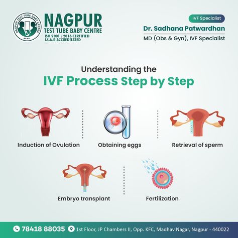 Are you curious about the IVF process? At Nagpur Test Tube Baby Centre, we break it down step by step to make your journey clearer and more comforting. From consultation to conception, we're with you every step of the way. 🌟💡 #nttbc #testtubebaby #testtube #TestTubeBabyCentre #nagpurtesttube #nagpur #hospital #gynaehealth #gynaecology #exploremore #explorepage #health #healthandwellness #IVF #ivflife #ivfexplained #FertilityJourney #StepByStep #ClearAndCompassionate #FutureFamily Baby Center, Test Tube, Fertility, Health And Wellness, Step By Step, The Way, Make It Yourself, Health, Quick Saves