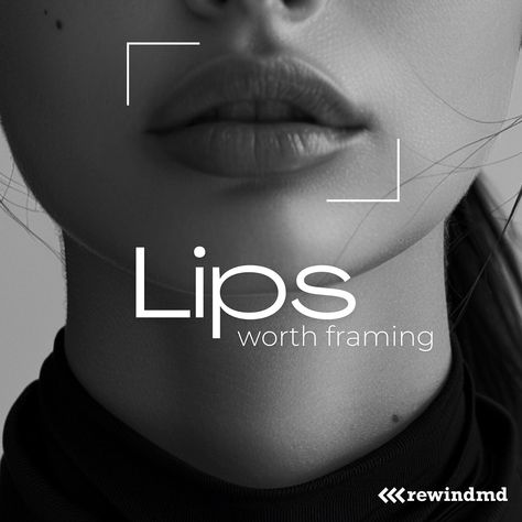 Enhance your natural beauty with lip fillers at RewindMD. We offer a range of top brands, including Juvederm®, Restylane®, and The RHA® Collection. Our expert nurses understand that each patient has unique goals and facial structures. Through careful analysis, we determine the best fillers to achieve your desired look. Schedule a consultation today! 🍒 Cherry financing is available with attractive low monthly payment options. Apply easily via the link in our bio. #RewindMD #SolanaBeach #R... Facial Analysis, Cosmetic Inspiration, Beauty Ads, Best Instagram Feeds, Skin Care Specialist, Facial Fillers, Instagram Feed Layout, Facial Aesthetics, Lip Filler