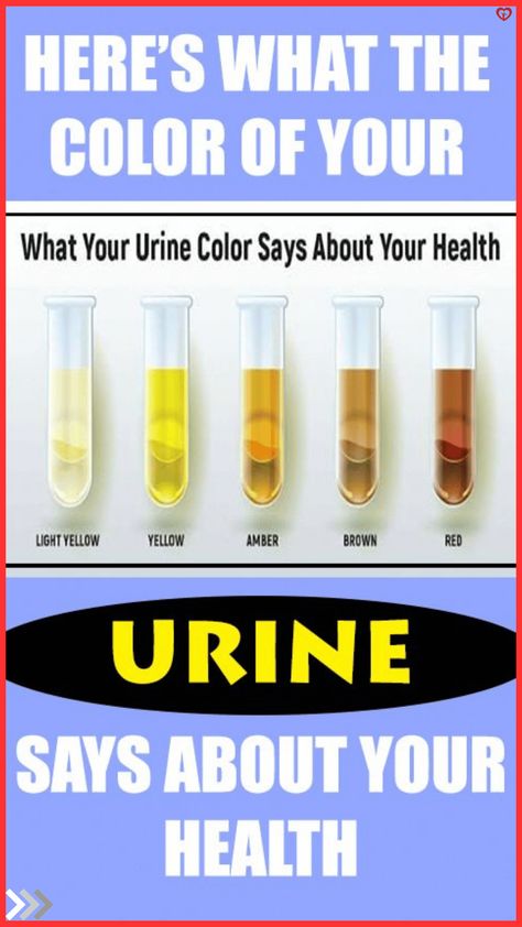 What Does My Pee Color Mean? Pee Color, Bilirubin Levels, Chemical Imbalance, Bile Duct, Body Organs, Healthy Beauty, Urinary Tract, Healthy Living Tips, Peachy Pink