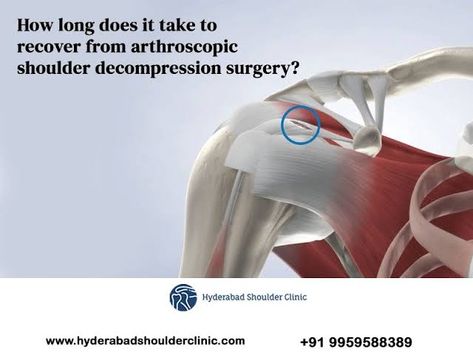 Arthroscopic Shoulder Surgery, Rotator Cuff Muscles, Pendulum Balls, Wall Push Ups, Shoulder Problem, Shoulder Impingement, Types Of Surgery, Shoulder Surgery, Rotator Cuff