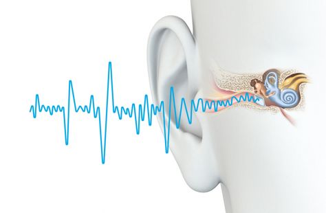 Ringing Ears Remedy, Upper Cervical Chiropractic, Hearing Loss, Earplugs, Cognitive Behavioral Therapy, Behavioral Therapy, Homeopathy, Chiropractic, Acupuncture