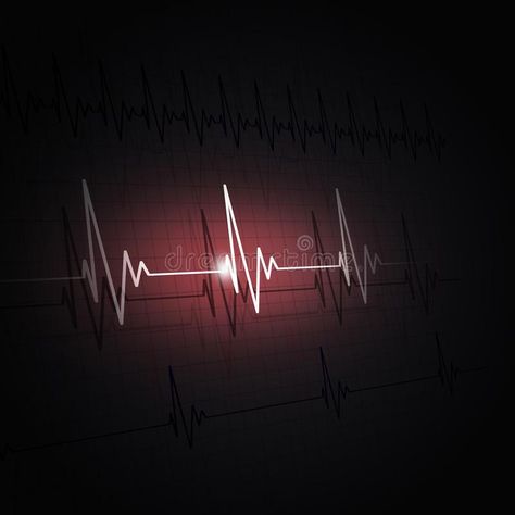 Rhythm of a Heart ecg. Heart pulsating ecg rhythm graph dark red background , #Sponsored, #ecg, #pulsating, #Rhythm, #Heart, #rhythm #ad Brain Neurons, Heart Rhythm, Dark Red Background, About Heart, Heart Rhythms, Heart Strings, Story House, Background Illustration, Vector Background