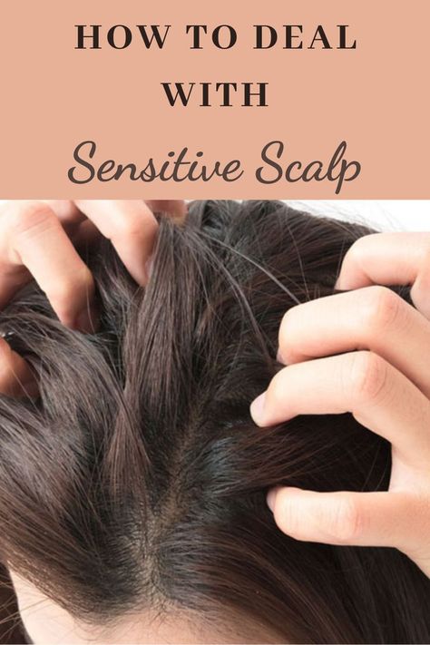 Hair Products For Sensitive Scalp, Best Shampoo For Sensitive Scalp, Best Shampoo And Conditioner For Dry Scalp, Hairstyles For Sensitive Scalp, Sensitive Scalp Remedies, Scaly Scalp, Oils For Dandruff, Natural Shampoo And Conditioner, Flaky Scalp