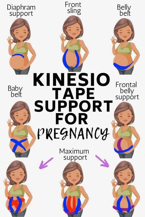 kinesiology tape support for pregnancy Taping Belly While Pregnant, Tape For Pregnant Belly, How To Tape Pregnant Belly, K Tape For Pregnancy, Kinesio Tape Pregnancy, Pregnancy Tape Belly, K Tape Pregnancy, Pregnancy Belly Taping, Taping Pregnant Belly