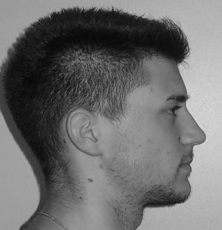 Convex Profile Face, Straight Nose Men, Mens Side Profile, Rhinoplasty Inspiration, Face Shapes Men, Face Reference Photo, Male Face Reference, Convex Profile, Prominent Nose