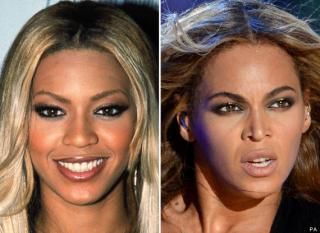 Beyonce Nose Job, Plastic Surgery Pictures, Botched Plastic Surgery, Celebrity Surgery, Nose Jobs, Plastic Surgery Photos, Rhinoplasty Surgery, Facial Plastic Surgery, Celebrity Plastic Surgery