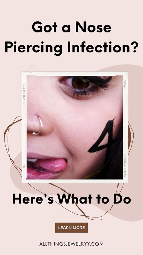 Getting a nose piercing is exciting, but an infection is no fun. This guide shares tips for treating and preventing infected nose piercings. Nose And Ear Piercings, Infected Nose Piercing, Nose Piercing Infection, Getting A Nose Piercing, Nose Infection, Different Types Of Piercings, Improve Nutrition, Nose Piercings, Types Of Piercings