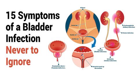 15 of Symptoms of a Bladder Infection Never to Ignore | 5 Minute Read Bladder Leakage Remedies, Med Math, Allergy Cough, Forms Of Birth Control, Urinary Tract Health, Urinary System, Bladder Leakage, Urinary Health, Feeling Fatigued