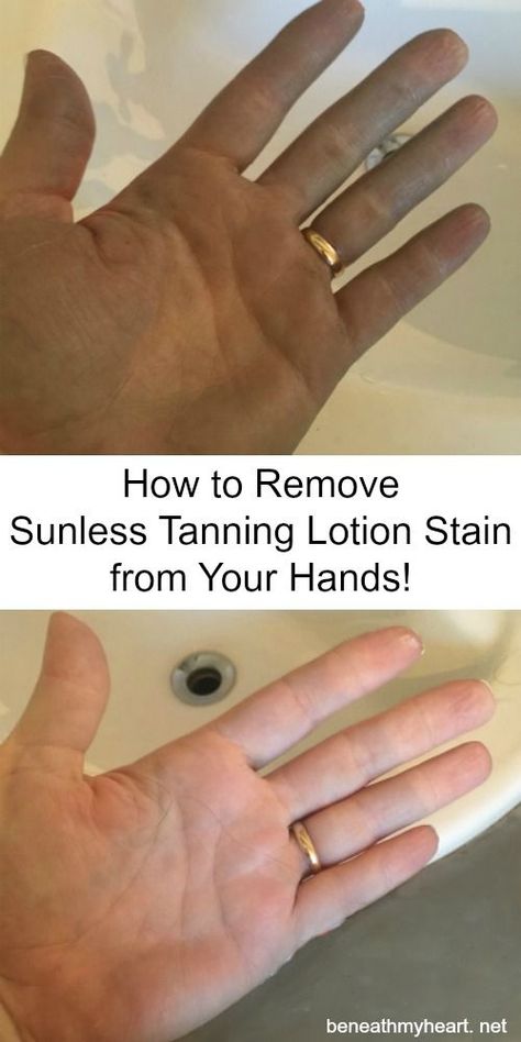 How to Remove Sunless Tanning Lotion Stains from Your Hands! Removing Self Tanner From Hands, How To Get Fake Tan Off, Remove Self Tanner From Hands, Self Tanner Remover Diy, How To Remove Spray Tan From Hands, How To Remove Fake Tan, How To Get Self Tanner Off Hands, How To Remove Self Tanner From Skin, How To Get Spray Tan Off Hands