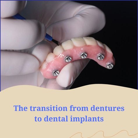 Are you not able to chew and cherish your food properly? Then it’s time you visit us at Oris dental center to check on our wide range of dental implants, that can help you wear comfortable fixed or removable dentures and smile with confidence. https://www.orisdentalcenter.ae/blog/the-transition-from-dentures-to-dental-implants/ Dentures Before And After Immediate, Permanent Dentures, Dental Dentures, Affordable Dentures, Affordable Dental Implants, Denture Implants, Dental Implants Cost, Partial Dentures, Implant Dentistry