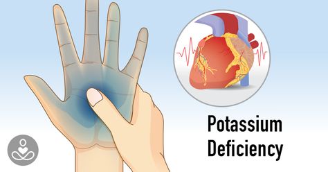 The Exact Amount of Potassium-Filled Foods You Need to Eat to Prevent Headaches, Weakness, and Fatigue Muscle Weakness And Fatigue, Prevent Headaches, Potassium Deficiency, Potassium Rich Foods, Headache Prevention, High Calcium, Muscle Weakness, Nutrient Deficiency, Mood Changes