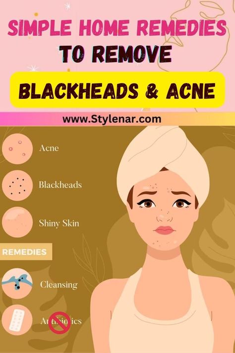 🌟✨ Combat blackheads and acne using easy home remedies! 🌟💖 Try tea tree oil, a baking soda scrub,cinnamon mask🍯🍋,a powerful natural antimicrobial, or a gentle honey and oatmeal scrub. 🍯🍵 Let's strive for clear, radiant skin the natural way. 🌿💁 Share the skincare love and let's glow together! 🌸 #SkincareMagic #ClearSkinNaturally #DIYRemedies #NaturalBeauty #SelfCareSunday 🚀 Baking Soda Scrub, Oatmeal Scrub, Clear Skin Naturally, To Remove Blackheads, Remove Blackheads, Shiny Skin, Diy Remedies, Skin Remedies, Simple Home