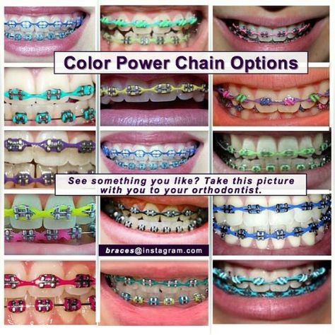 Color Power chains Brace Color Combinations, Braces Chain Colors, Purple Power Chain Braces, Cutest Braces Colors, Silver Power Chain Braces, Gold Braces With Color Bands, Power Chain Braces Colors, Braces Power Chain, Braces Colors Ideas Power Chains