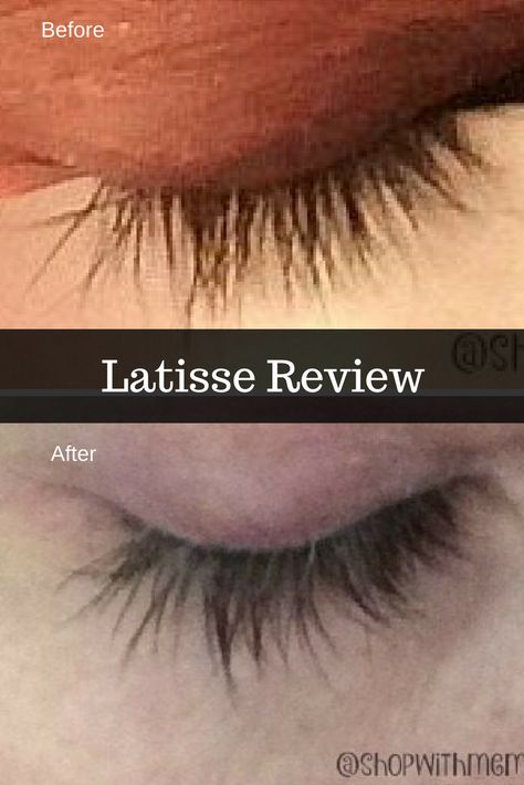 Latisse Before And After Eyelashes, Latisse Before And After, Latisse Eyelashes, Not A Day Over Fabulous, Silver Dragonfly Necklace, Bible Verses For Women, Gifts For Aunt, Heart Shaped Pendant Necklace, Swarovski Crystal Jewelry