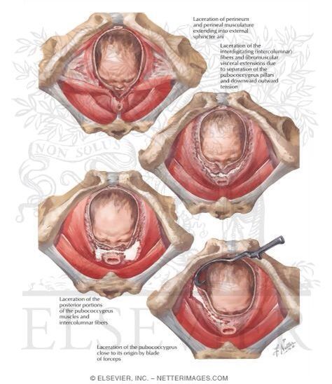 Fertile Woman, Perineal Tear, Basic Anatomy And Physiology, Human Body Anatomy, Call The Midwife, Childbirth Education, Biology Lessons, Nursing School Tips, Pregnancy Nutrition