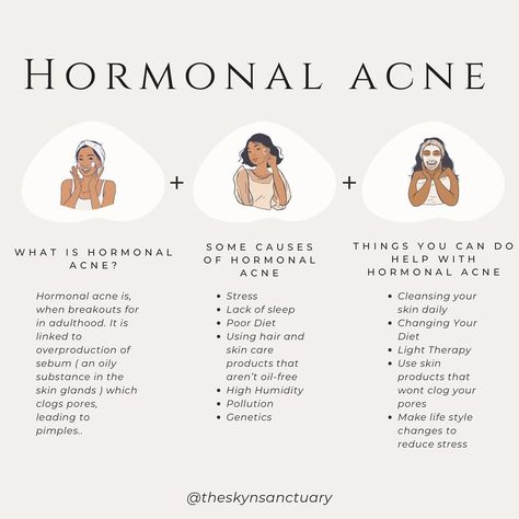 Hormonal acne is when breakouts form in adulthood that could range from blackheads and whiteheads to painful cysts. Hormonal acne is linked to the overproduction of sebum (an oily substance in skin glands), which clogs pores, leading to pimples. Though often unavoidable, hormonal acne can be treated to prevent future breakouts from forming. #hormonalacne #hormonalacnetreatment #hormonebalance #acne #acnesafeproducts #acnefacialtreatment #theskynsanctuary #esthetician #estheticianmeme #estheti... Treating Hormonal Acne, Hormonal Chin Acne, How To Heal Hormonal Acne, How To Clear Hormonal Acne, Esthetics Content, Detox Aesthetic, Hormonal Acne Skincare Routine, Period Pack, The Substance